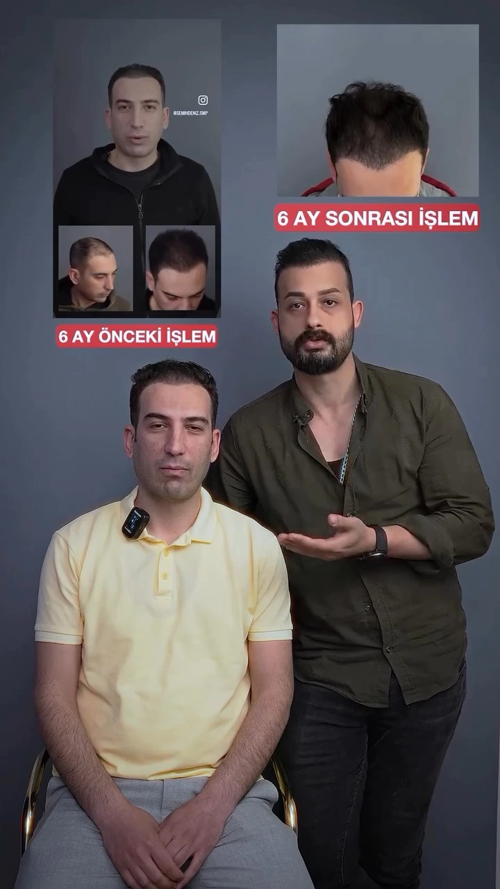Altı ay takip görüşmesinden iki kişilik kare ve üst bölümde önceki uygulama ile altı ay sonraki görünümü karşılaştıran kolaj