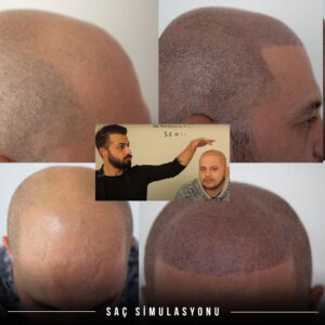 elazığ saç simülasyonu